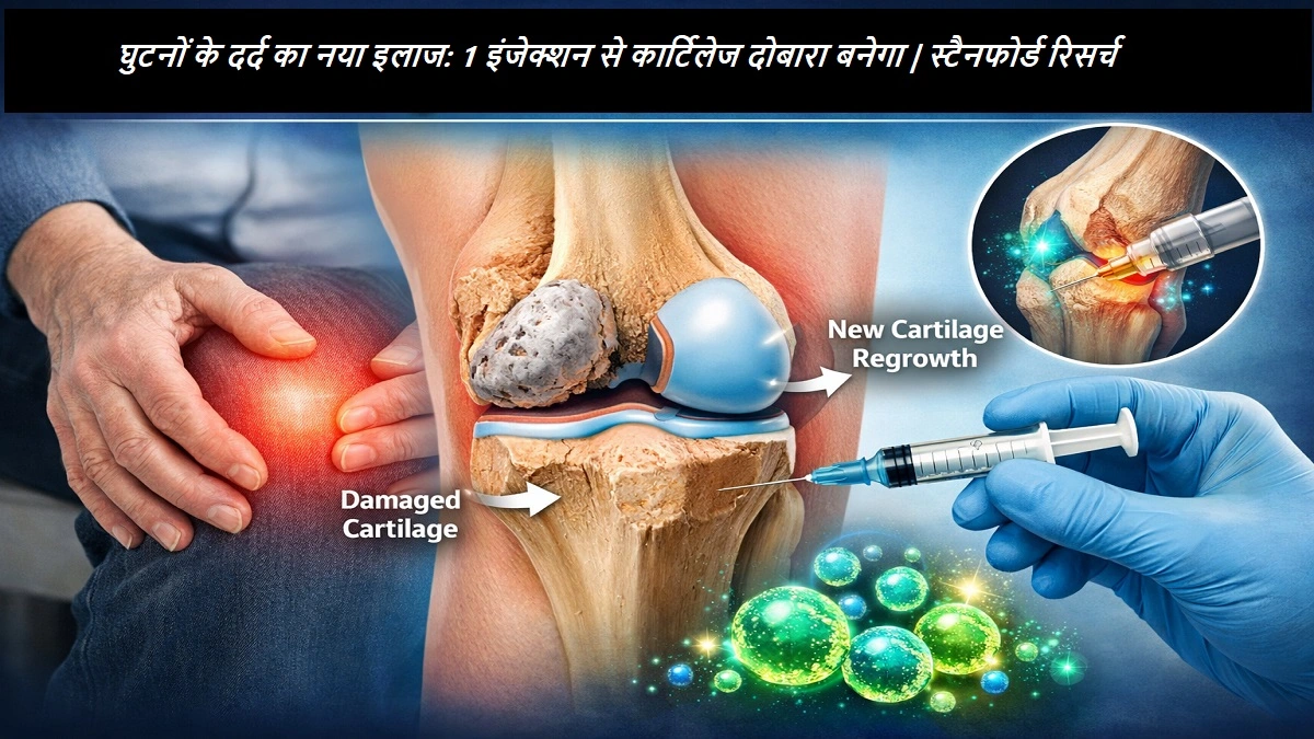 घुटनों के दर्द और ऑस्टियोआर्थराइटिस के मरीजों के लिए कार्टिलेज रीजनरेशन इंजेक्शन का इलाज